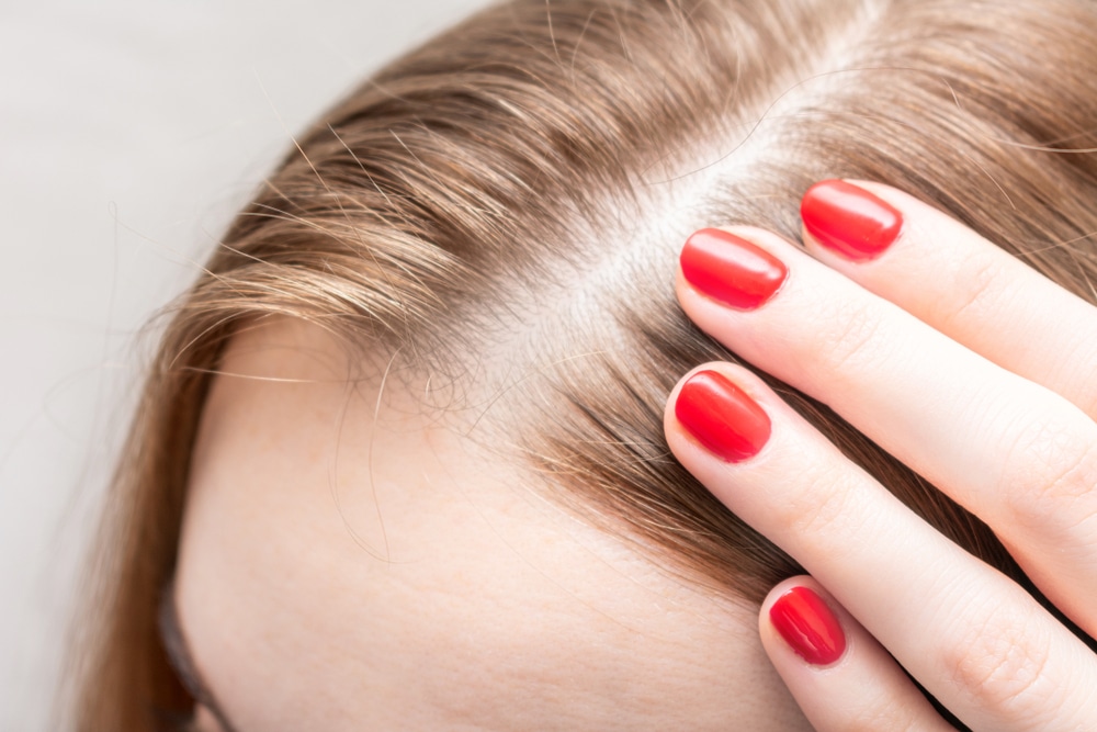 Hair Growth Treatments in Derry, NH