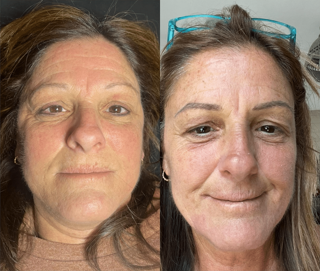 Permanent Brows in Derry, NH