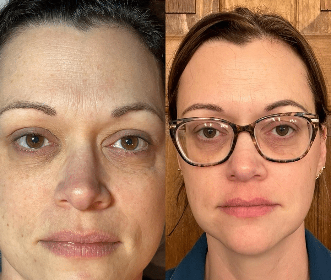 Permanent Brows in Derry, NH
